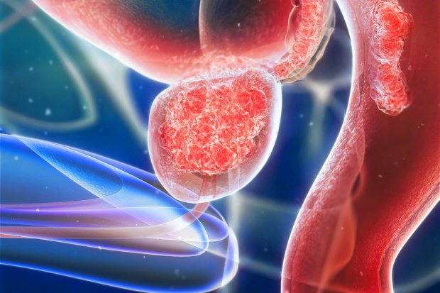 Naukowcy brytyjscy pracują nad nowym lekiem na raka prostaty UK: przełom w leczeniu raka prostaty?