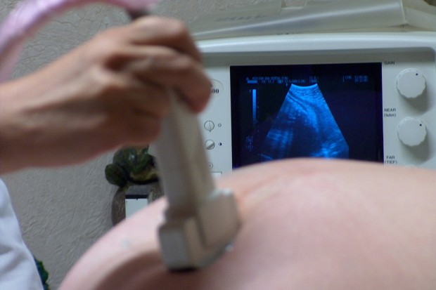 Czym skutkuje duży przyrost wagi na wczesnym etapie ciąży?