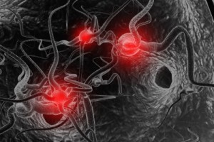 Ekspert: cukrzyca daje również objawy neurologiczne