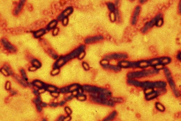 Bacillus anthracis Bułgaria: wąglik w mięsie sprzedawanym w sklepach