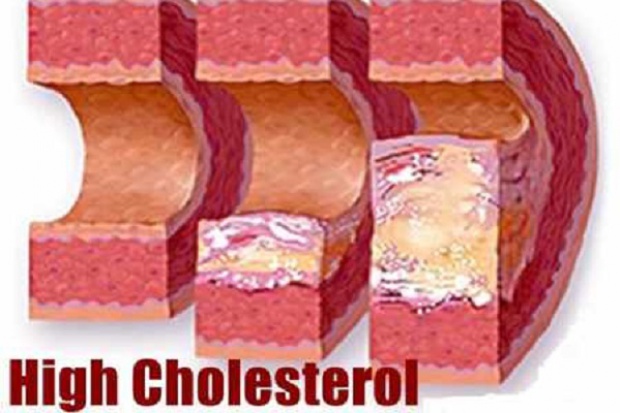 Obniżył poziom "złego" cholesterolu skuteczniej niż statyny
