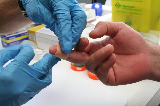 Kalifornia obniża karę za świadome zarażenie wirusem HIV