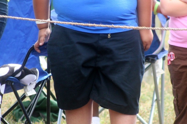 Stymulacja magnetyczna mózgu ułatwia walkę z nadwagą Stymulacja magnetyczna mózgu pomaga zgubić zbędne kilogramy