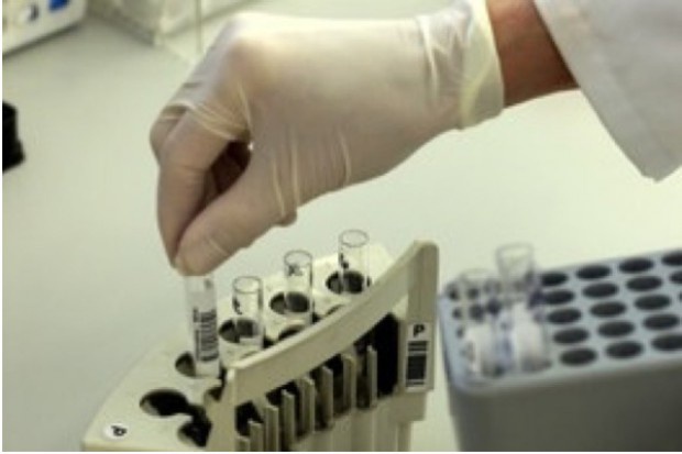 Kwas omega-3 może pomagać komórkom wysyłać sygnały o działaniu przeciwzapalnym, dzięki czemu układ odpornościowy nie generuje reakcji autoimmunologicznej. Omega-3 mogą chronić organizm przed rozwojem tocznia
