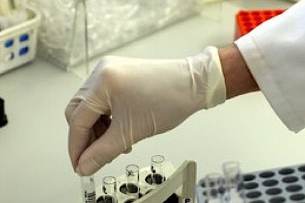 Położna w celu zwiększenia dostępności do badań cytologicznych, będzie mogła pobierać wymazy w domu od swoich pacjentek. Opole: cytologia w domu pacjentek