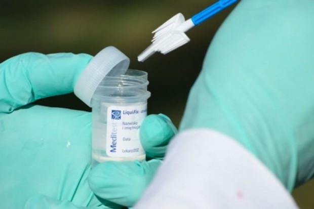 82 proc. Polek co najmniej raz w życiu wykonało badanie cytologiczne Polki wraz z wiekiem wykonują cytologię coraz rzadziej