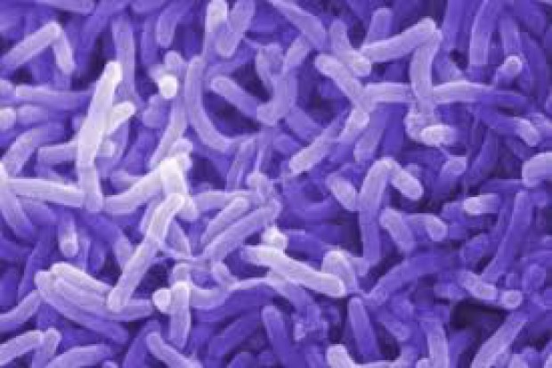 Cholera to ostra bakteryjna choroba przewodu pokarmowego wywoływana przez spożycie skażonej wody i jedzenia Jemen: władze apelują o pomoc w powstrzymaniu epidemii cholery