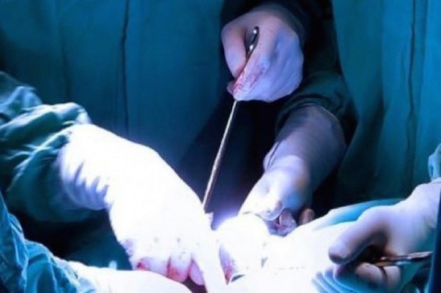 UK: chirurg wypalał swoje inicjały na przeszczepionych narządach 