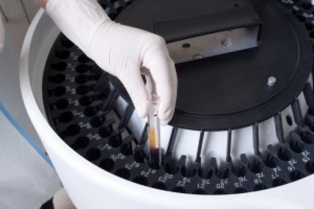 Diagności laboratoryjni nie chcą podpisu elektronicznego. "To może prowadzić do nadużyć"