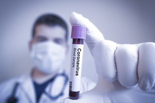 Główny Inspektor Sanitarny nie zaleca podróżowania do Chin, Hongkongu oraz Korei Południowej, Włoch, Iranu i Japonii (fot. archiwum) GIS: 3,2 tys. zgonów z powodu koronawirusa. Wzrost zachorowań w Chinach