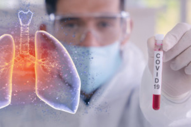 Tocilizumab podany pacjentom z COVID-19 hamuje występowanie objawów zagrażających życiu -wskazuje szpital (Fot. Archiwum) Szpital MSWiA: ten lek znalazł swoje drugie życie w leczeniu COVID-19