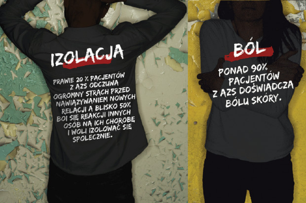 Stany lękowe i depresja. To codzienność atopika (fot. materiały prasowe) Projekt: usłyszeć krzyk duszy. Zrozumieć AZS