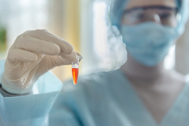 Brytyjskie władze rozmawiają z Roche o zakupie milionów zestawów testowych (Fot. Archiwum) UK: rząd planuje zastosować test Roche na przeciwciała COVID-19