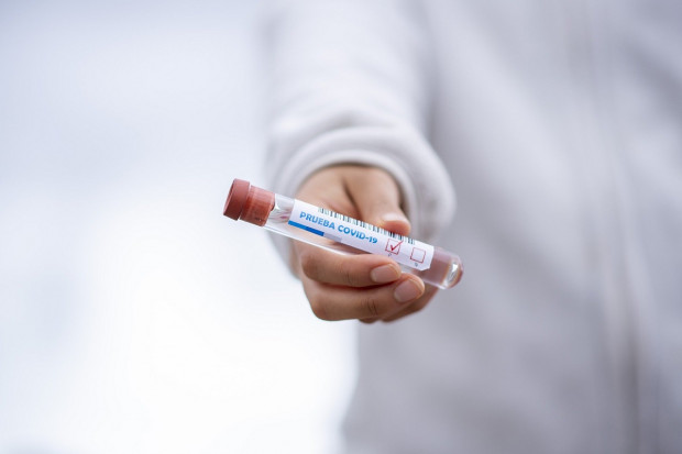 Firma opracowała prosty test antygenowy na covid-19. Będzie dostępny m.in. w aptekach