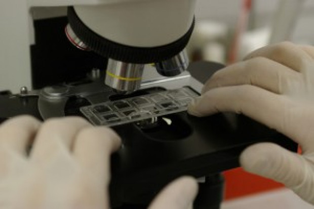 Potrzebny program badań przesiewowych wstrzymuje pandemia (Fot. Archiwum) Wirus HCV: gdyby nie pandemia, wszystkich chorych udałoby się wyleczyć
